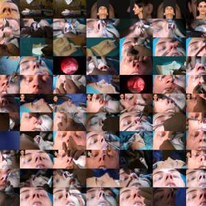 Assoc. Prof. Barış Çakır, MD: Closed Polygon Tip Low Septal Strip Osteocartilaginous Dorsal Preservation - Live Surgery (4th Bergamo-Istanbul Course)